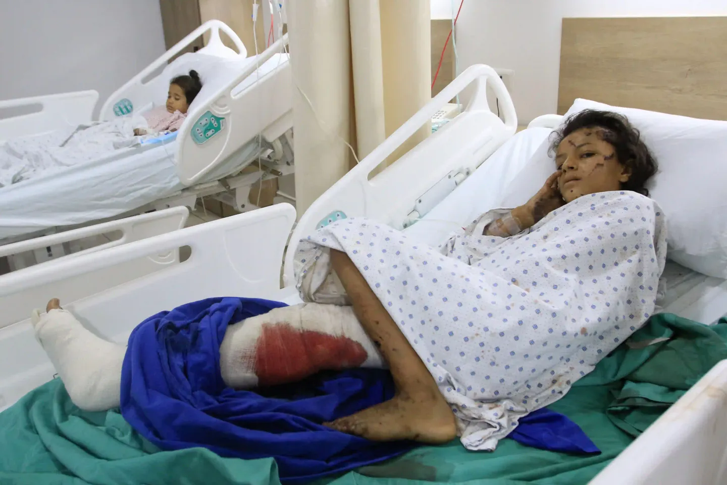 ONU: Gaza compte le plus grand nombre d'enfants amputés au monde