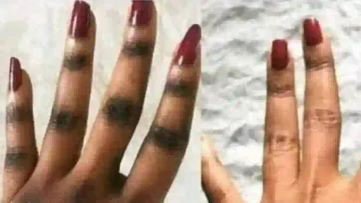 Somalians dey campaign for natural skin beauty