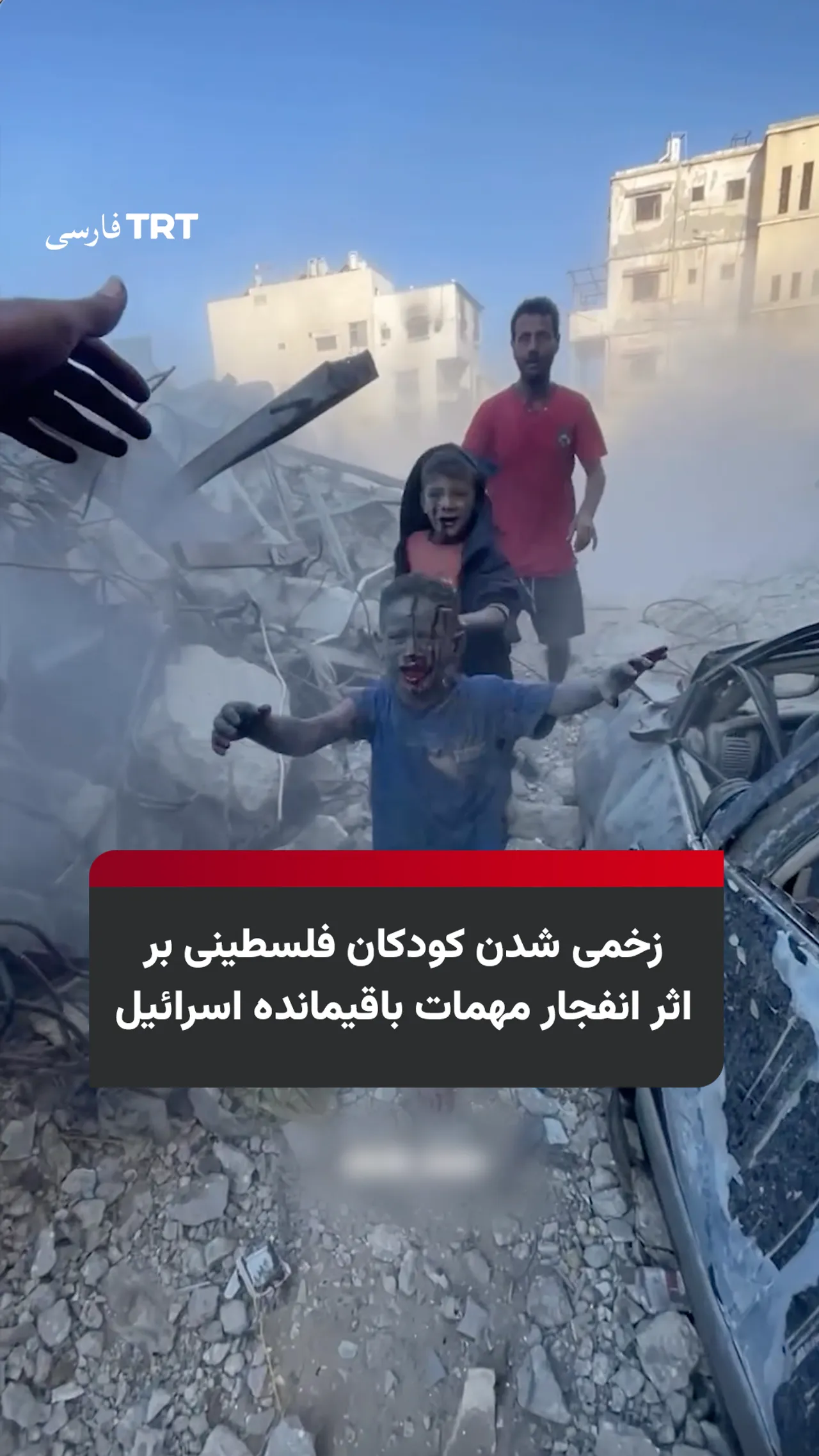 زخمی شدن کودکان فلسطینی بر اثر انفجار مهمات باقیمانده اسرائیل