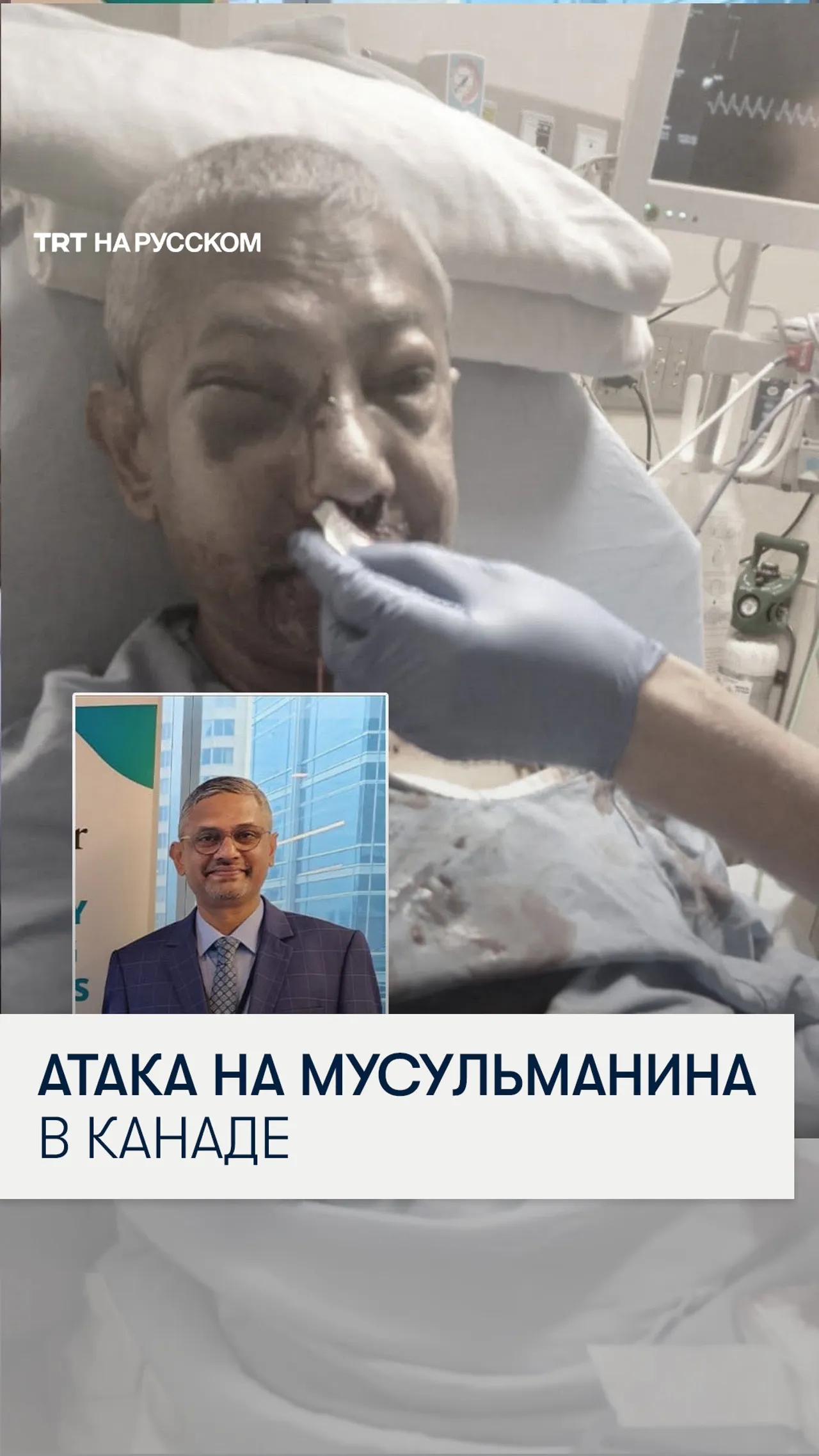 В Канаде жестоко избили сотрудника гостиницы на почве исламофобии