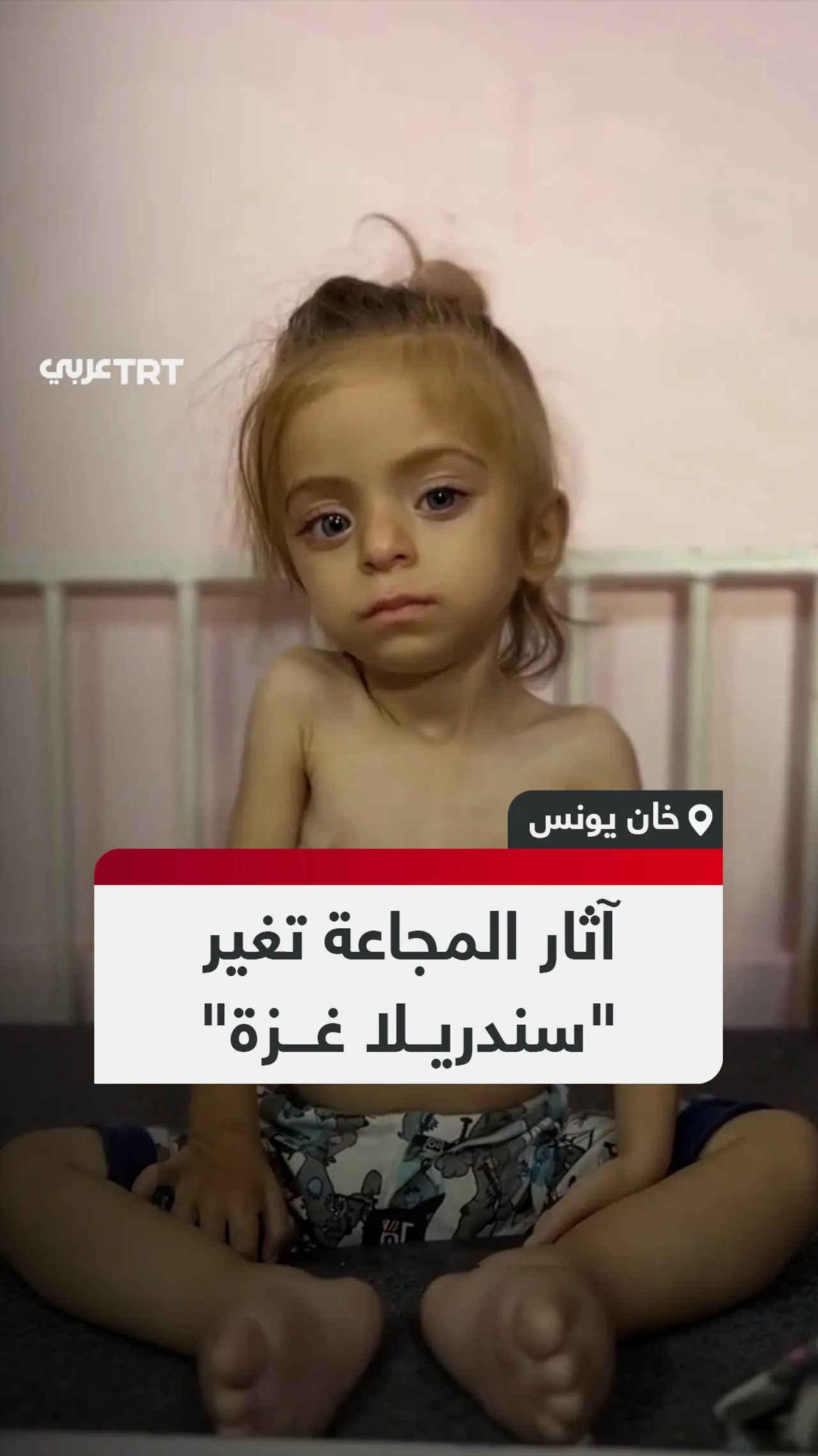 آثار المجاعة تغير
"سندريلا غزة"