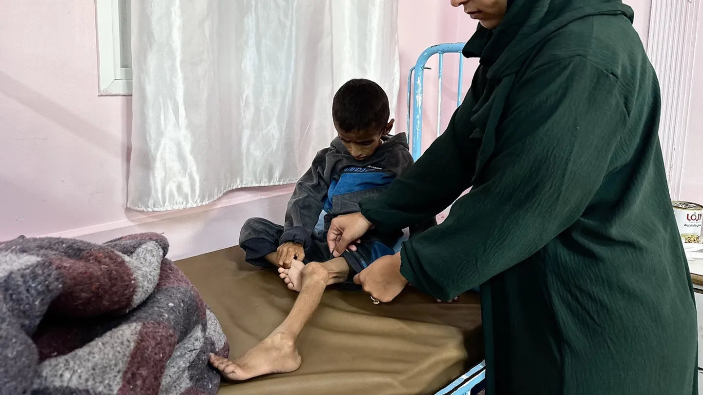 عامان من الإبادة.. سياسة التجويع الإسرائيلية تحصد أرواح أطفال غزة