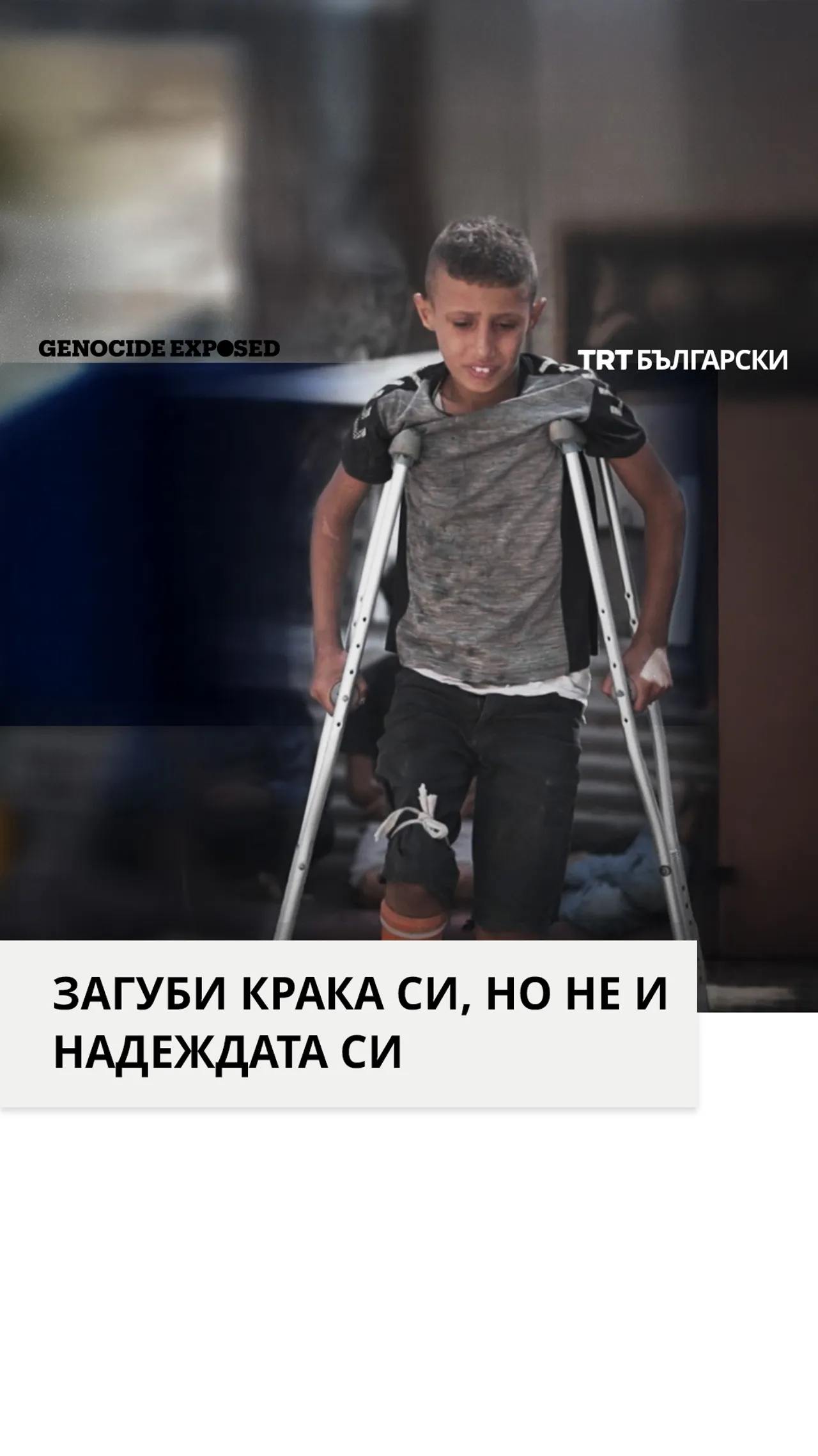 ЗАГУБИ КРАКА СИ, НО НЕ И НАДЕЖДАТА СИ