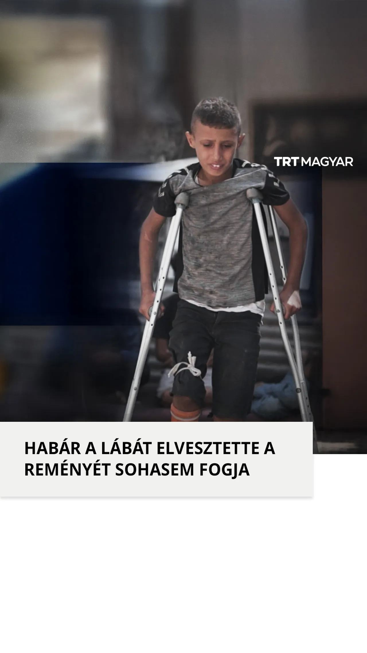 Egy 9 éves palesztin gyermek, aki amputáción esett úgy döntött, hogy talpra áll