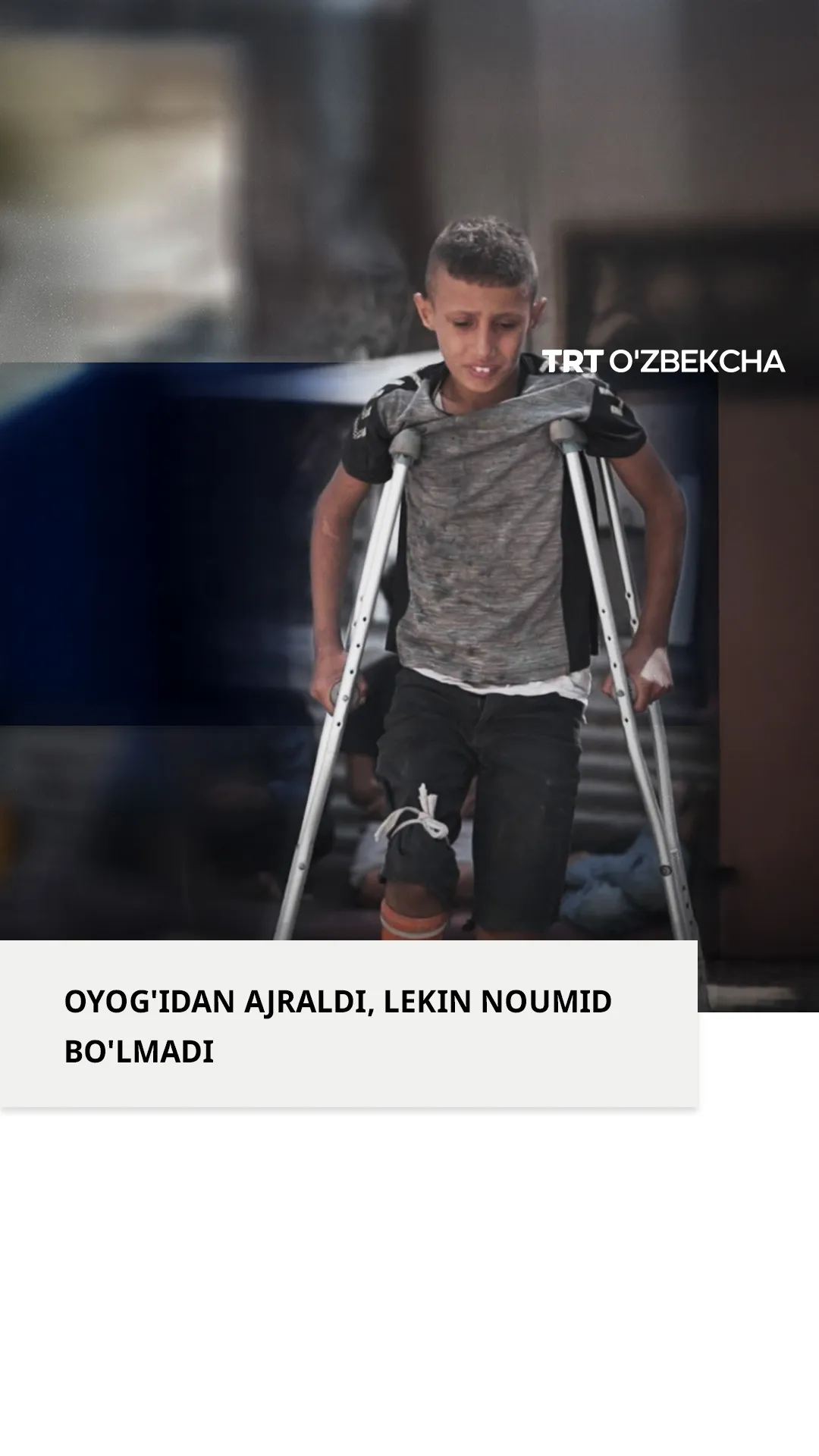 Falastinlik bola o'ziga plastmassadan protez yasadi