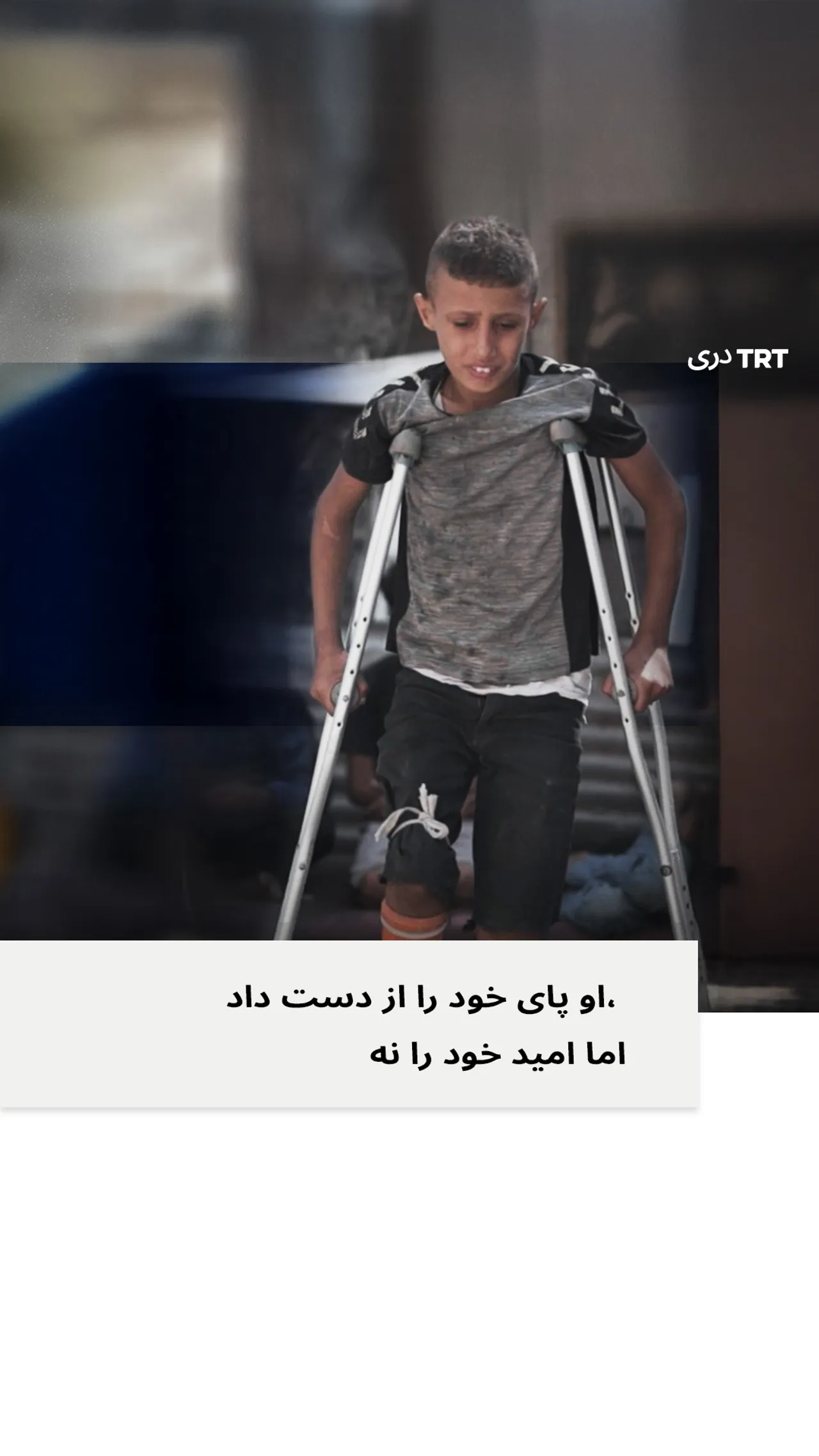 او با وجود قطع پایش امید خود را از دست نداده است