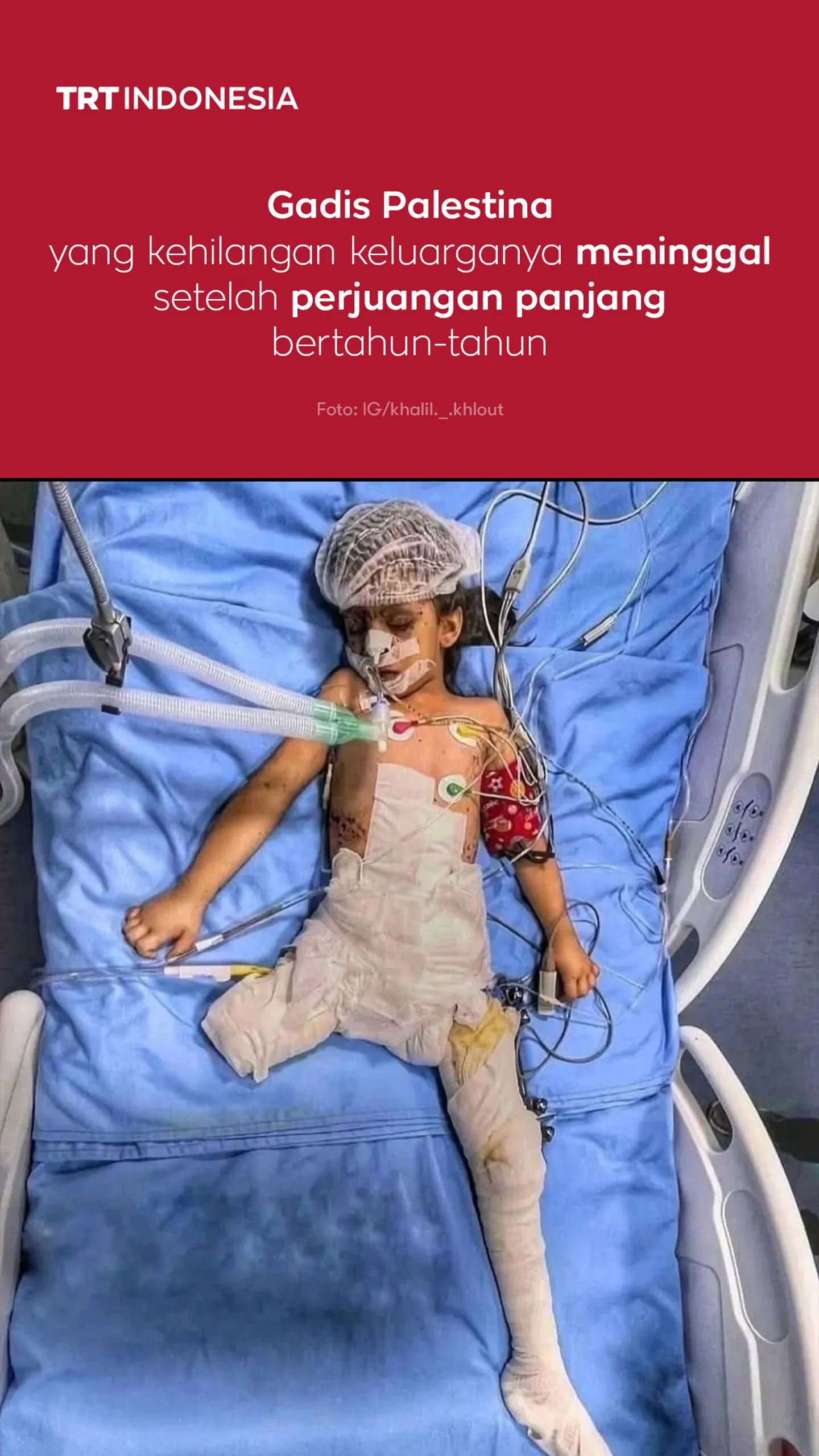 Gadis Palestina yatim piatu meninggal setelah bertahun-tahun berjuang