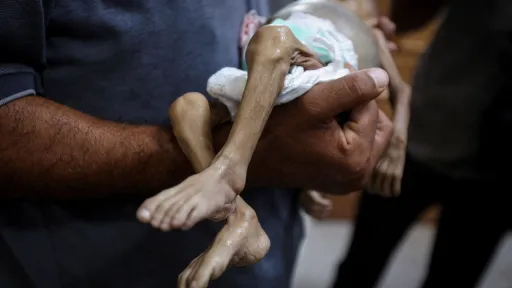 غزة.. أزمة وقود خانقة بالمرافق الحيوية وتفاقم سوء التغذية الحاد بين الأطفال وسط استمرار القصف