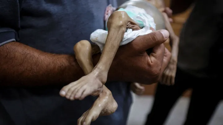 غزة.. أزمة وقود خانقة بالمرافق الحيوية وتفاقم سوء التغذية الحاد بين الأطفال وسط استمرار القصف