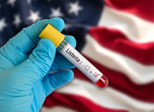 Šestero mrtvih, 25 hospitalizovanih u SAD-u zbog epidemije listerije
