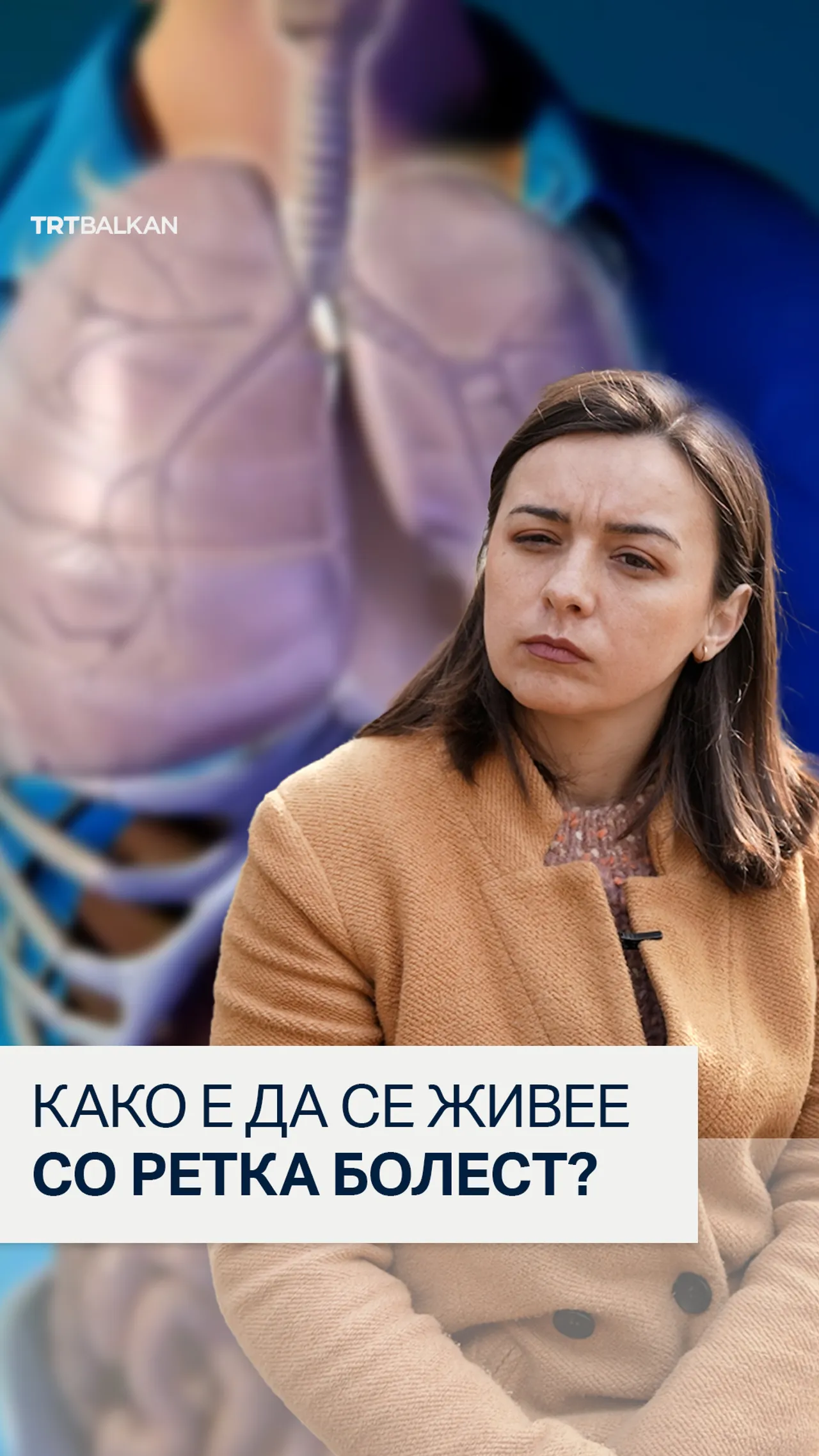 Како е да се живее со ретка болест?