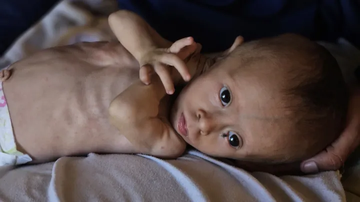 یونیسف: تولد نوزادان کم‌وزن در غزه به‌طور چشمگیری افزایش یافته است