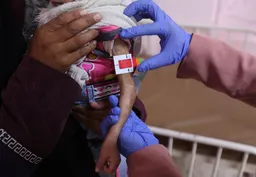 سازمان ملل: نزدیک به ۹۵ هزار کودک در سال ۲۰۲۵ در غزه دچار سوءتغذیه شده‌اند