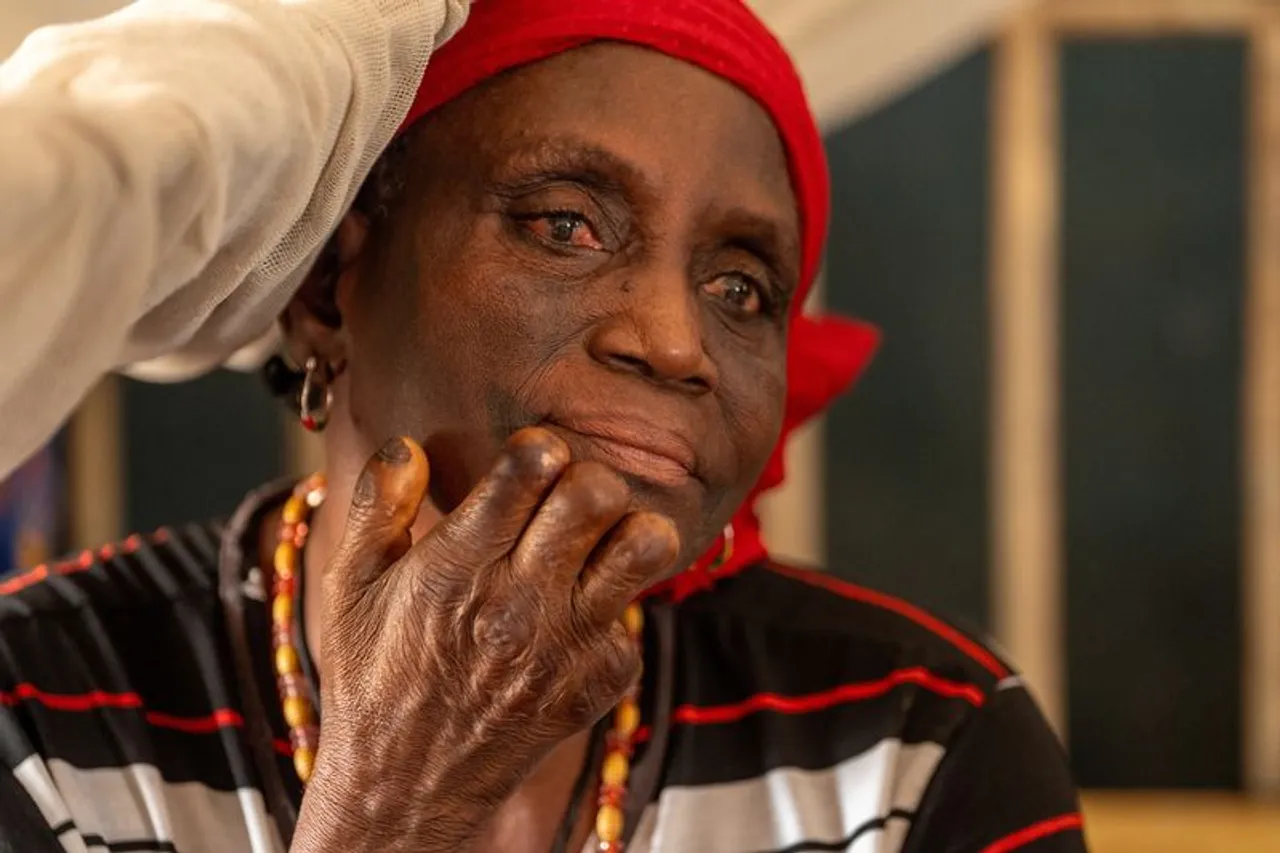 Nigeria to receive leprosy drugs to tackle 'strange painful situation'