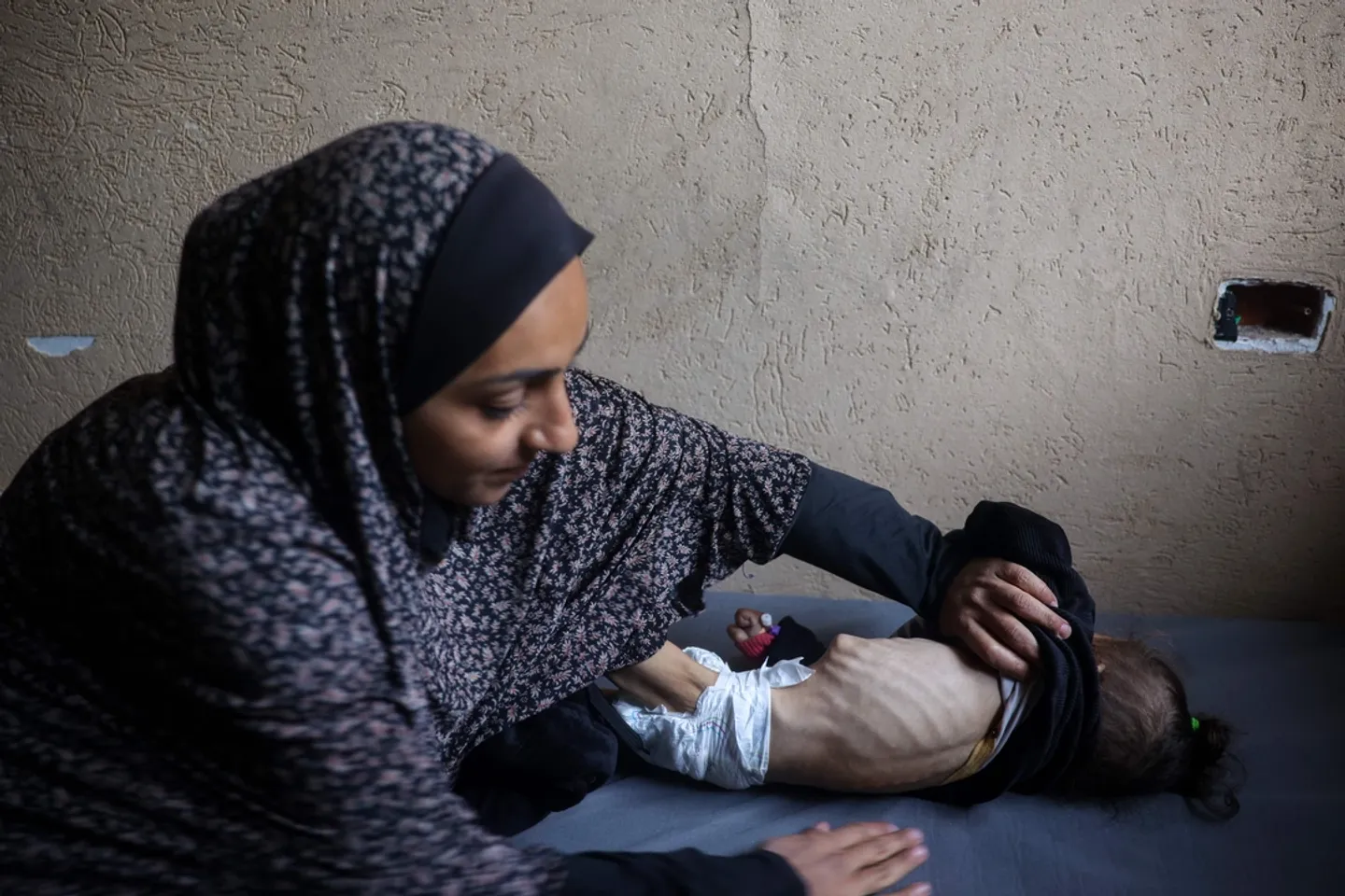 Is Yemen’s malnutrition crisis reaching irrevocable levels amid aid cuts?