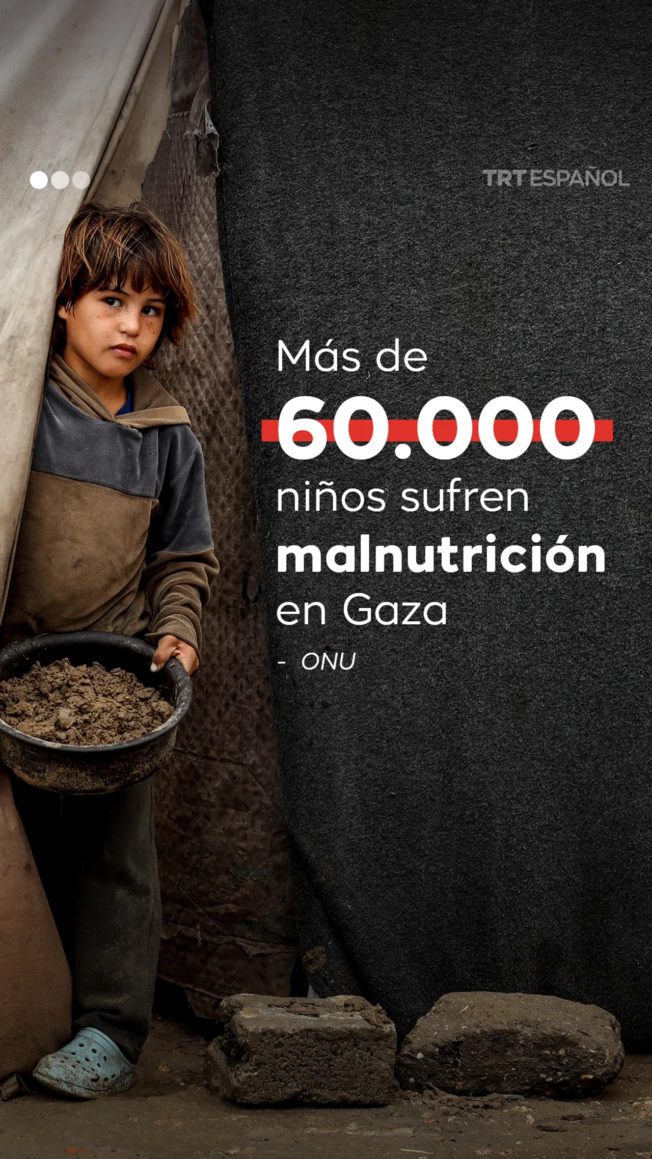 Más de 60.000 niños sufren malnutrición en Gaza: ONU