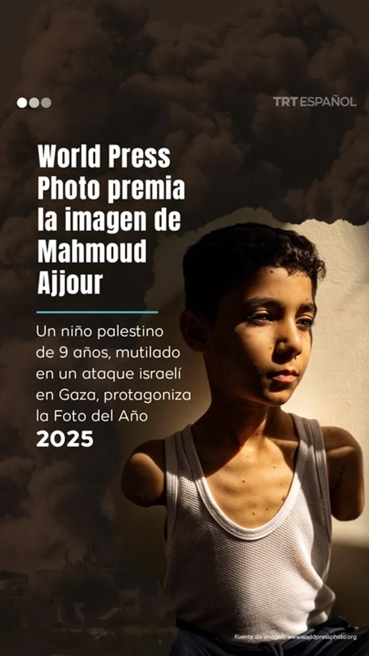 World Press Photo premia la imagen de niño palestino mutilado por Israel