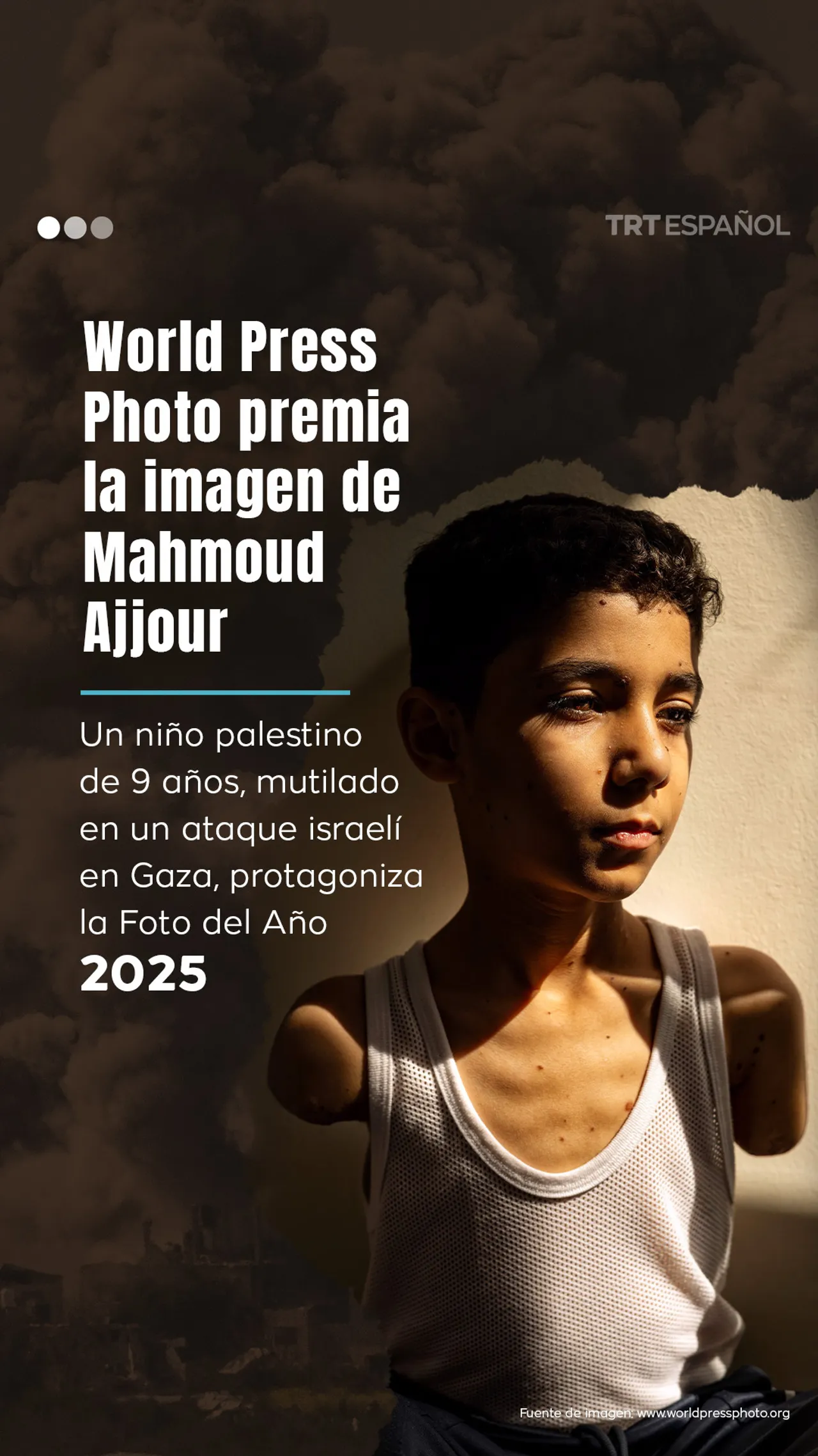 World Press Photo premia la imagen de niño palestino mutilado por Israel