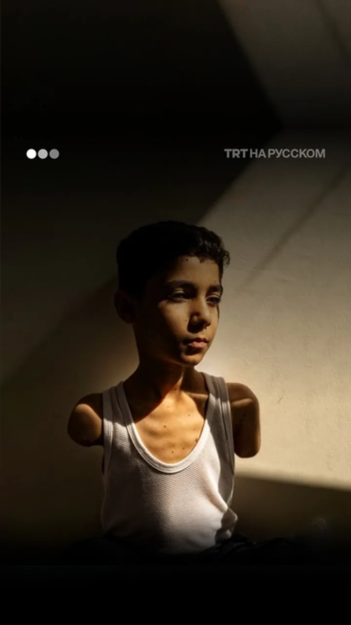 Символ трагедии Газы — на фото года по версии World Press Photo