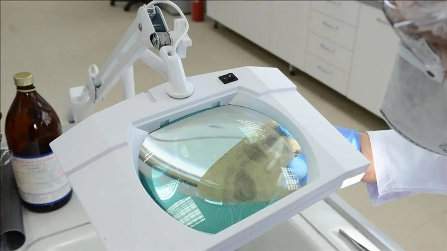 Mjeti i kompanisë AliBaba për zbulimin e kancerit me inteligjencë artificiale merr dritë jeshile