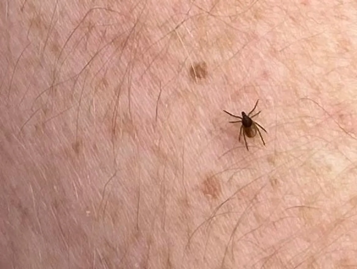 Japan on alert after vet dies from suspected cat-borne tick virus