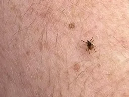 Japan on alert after vet dies from suspected cat-borne tick virus