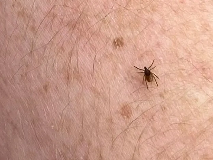 Japan on alert after vet dies from suspected cat-borne tick virus