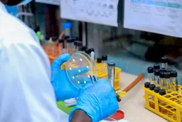 Serikali ya DRC yathibitisha mlipuko wa ugonjwa wa Kimeta