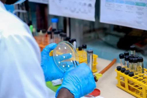 Serikali ya DRC yathibitisha mlipuko wa ugonjwa wa Kimeta