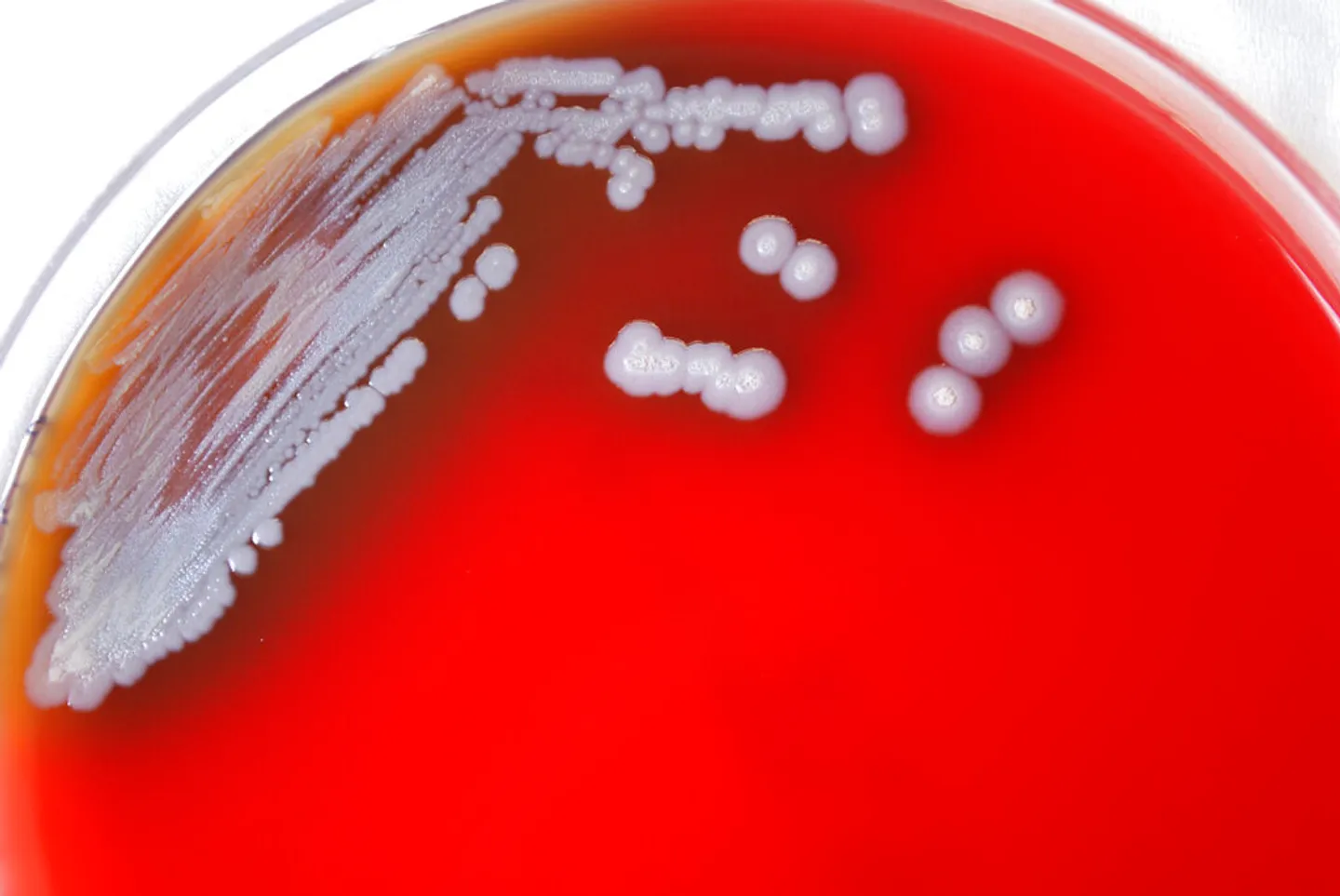 Australia faces major melioidosis outbreak as death toll surges