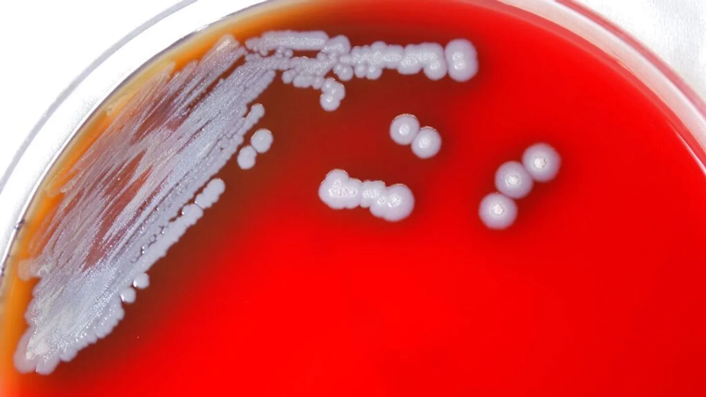 Austrália enfrenta grande surto de melioidose à medida que número de mortos aumenta