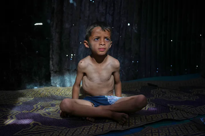 Do you know what a starving child in Gaza goes through?