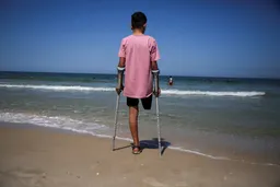 Gaza’s limbless children, victims of Israeli strikes, and the world looks away