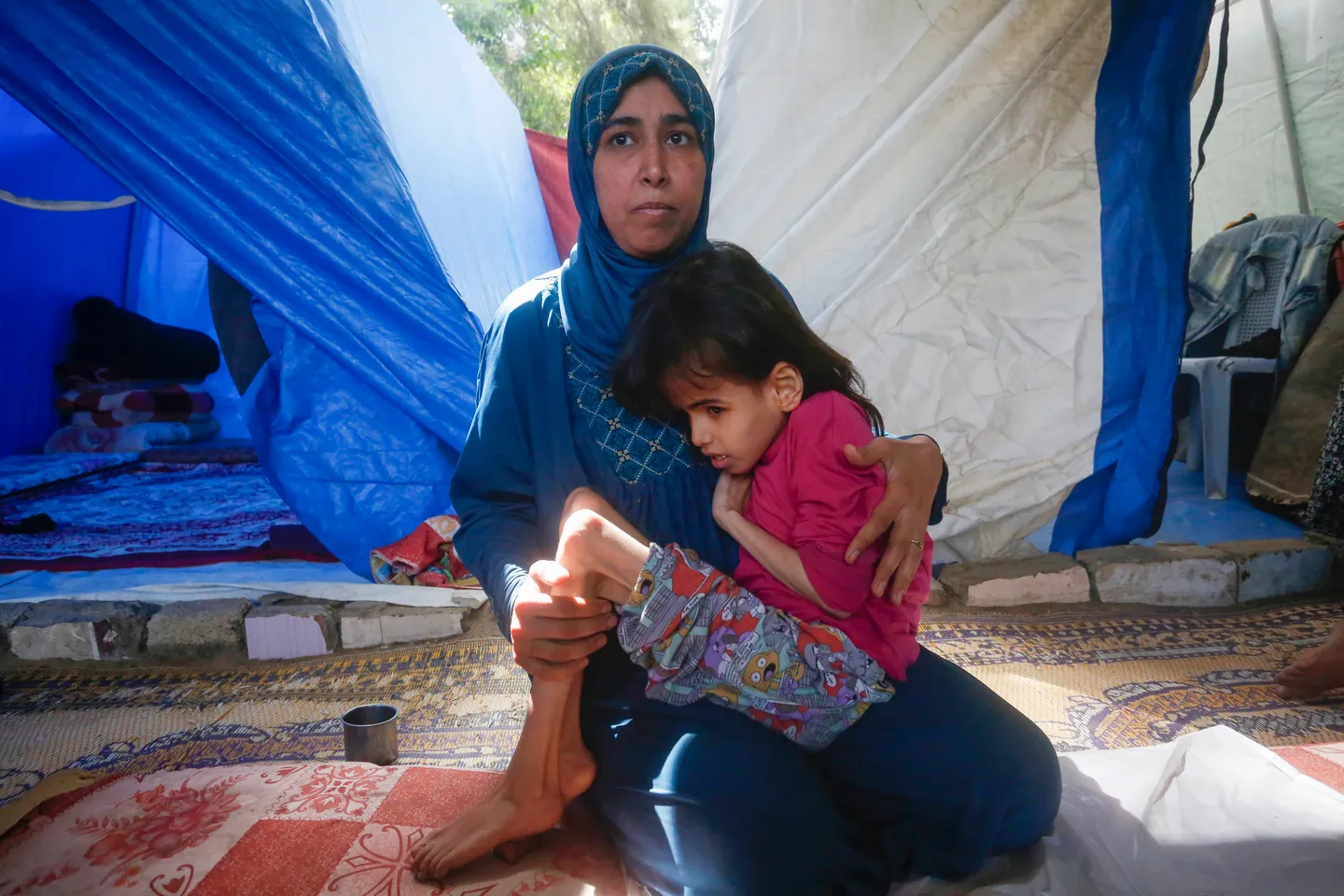 Gaza girl’s fight for life reveals a generation’s silent hunger