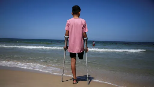 As crianças amputadas de Gaza, vítimas dos ataques israelitas, e o mundo que finge que não vê