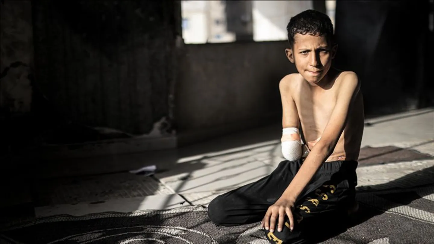 Ahmedi nga Gaza, i cili u sulmua nga Izraeli ndërsa luante futboll, dëshiron t'i kthehet dora