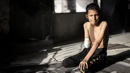 Ahmedi nga Gaza, i cili u sulmua nga Izraeli ndërsa luante futboll, dëshiron t'i kthehet dora