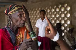 Trachoma: Ta'azzarar amosanin ido da ke makanta mutane na ƙarfafa fafutukar dawo da gani a Afirka