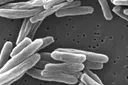 L'OMS alerte sur la résistance aux antimicrobiens