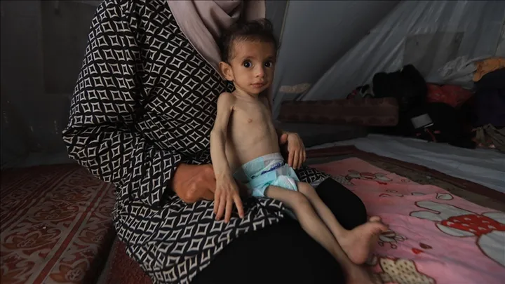 66 children die of hunger in Gaza under Israeli blockade