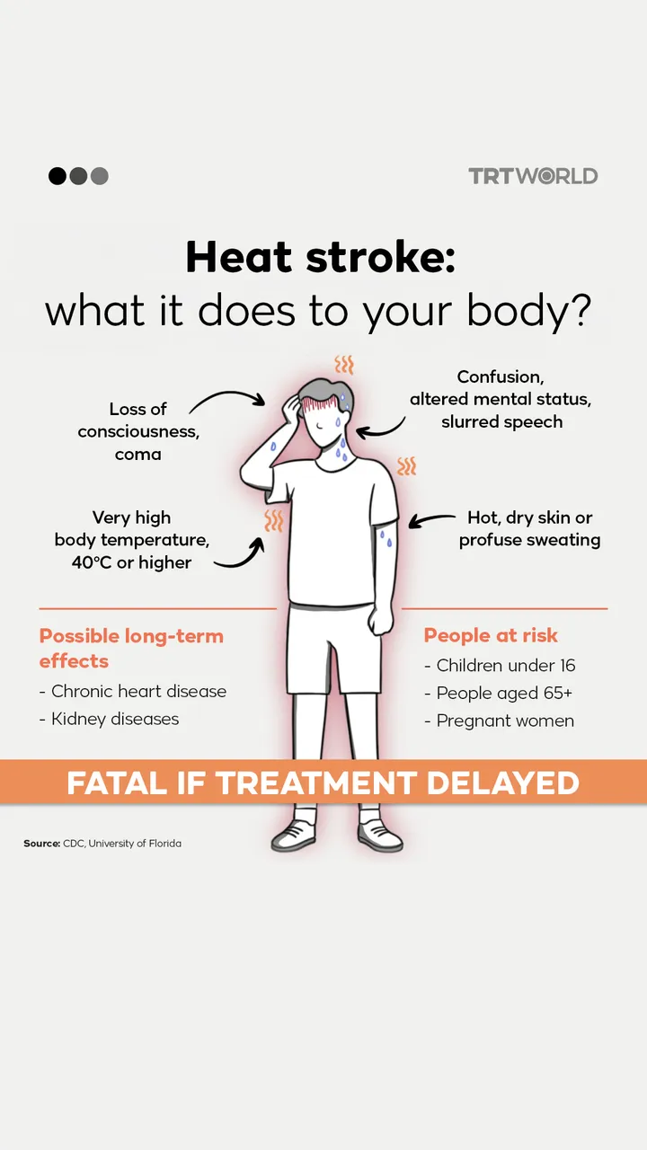 Heat stroke