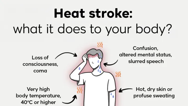 Heat stroke