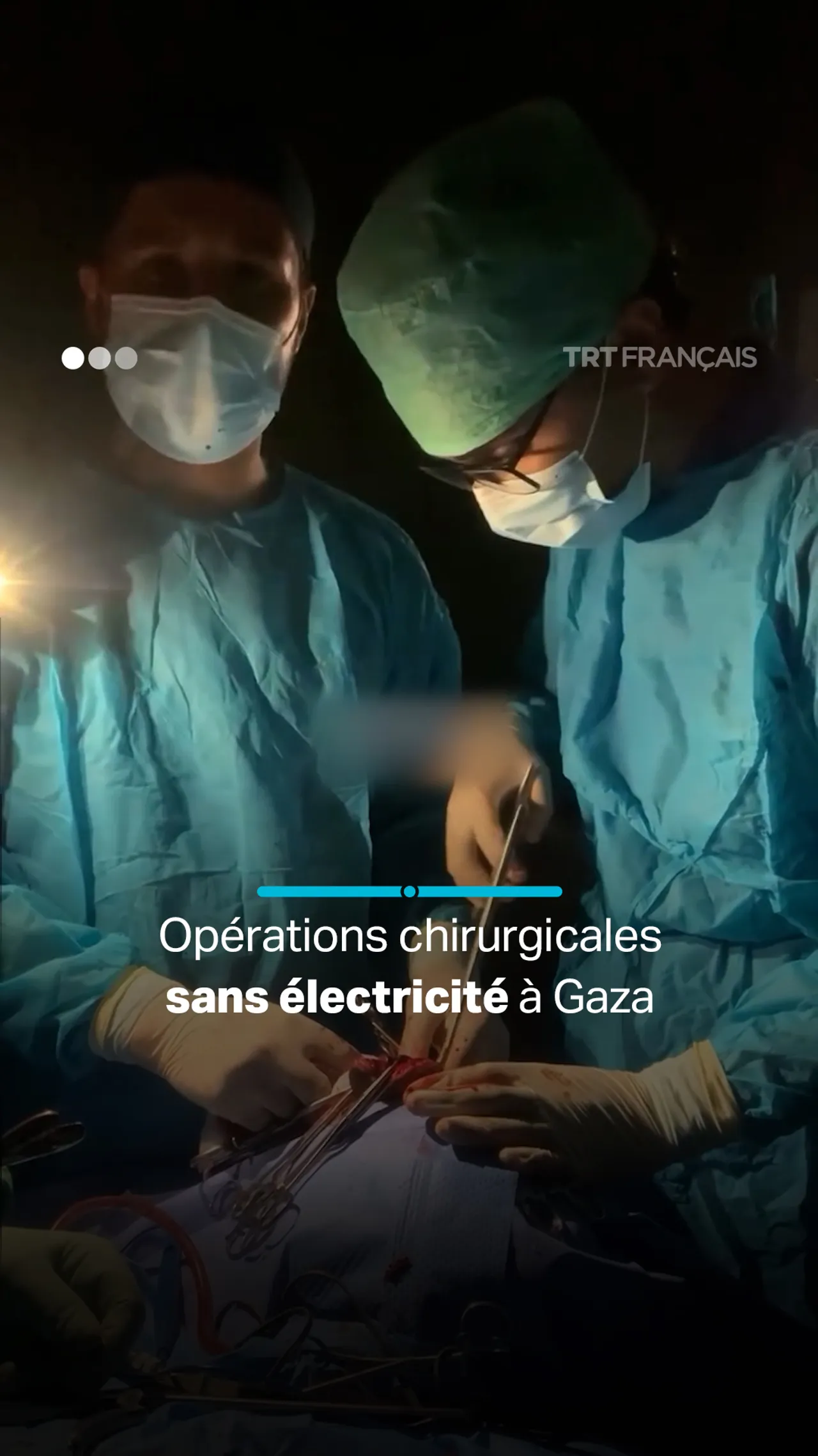 Une opération chirurgicale critique pratiquée sans électricité à Gaza