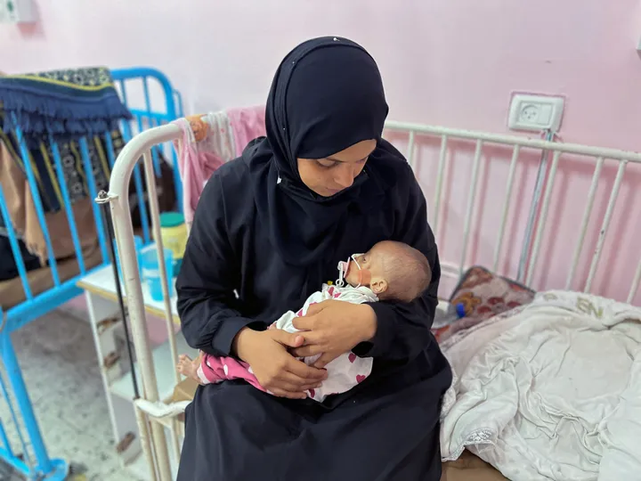 La mortal desnutrición infantil en Gaza es una estrategia “fabricada” por Israel, denuncia la ONU
