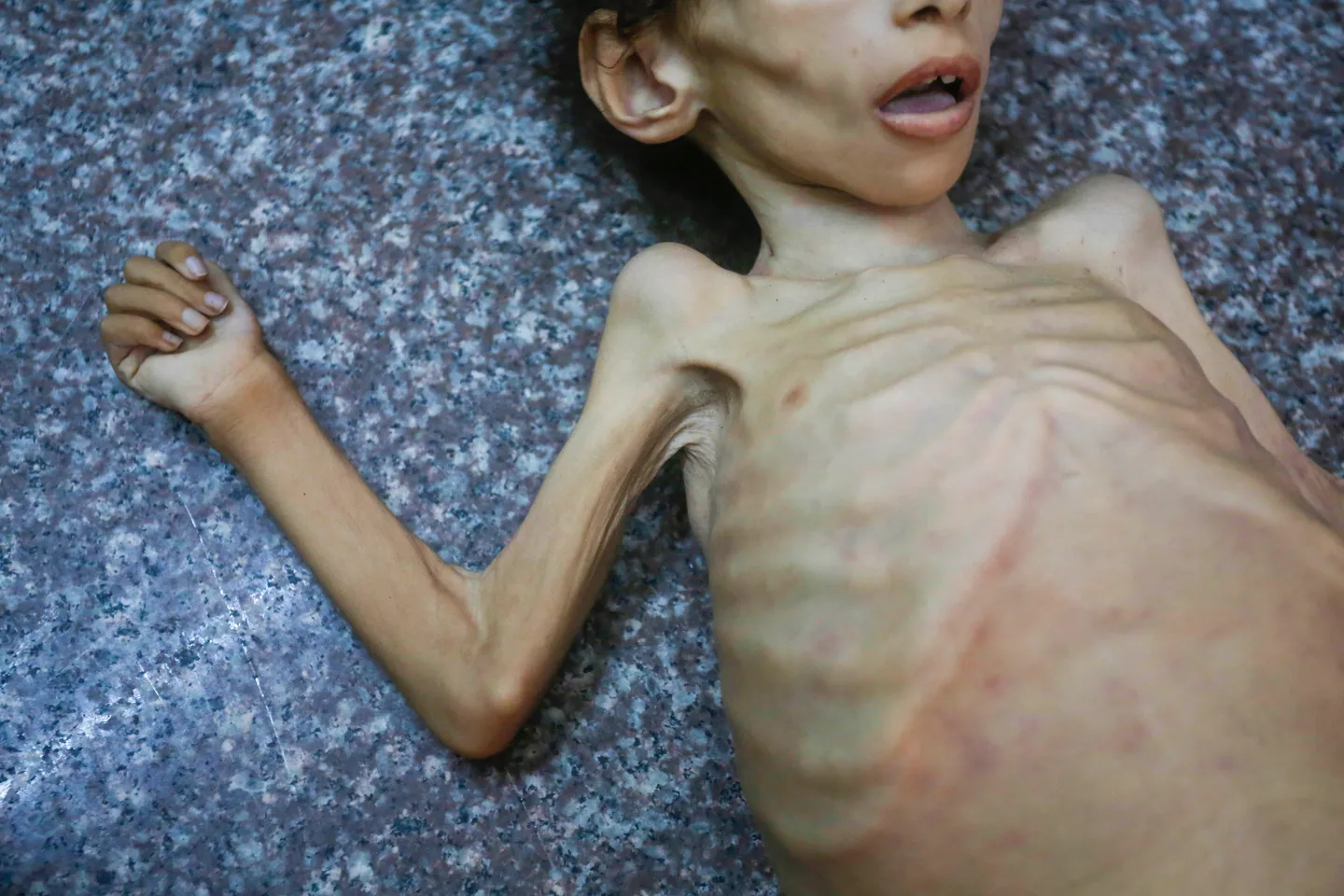 Gaza: un bébé de 35 jours mort de malnutrition, au moins 39 demandeurs d’aide alimentaire tués