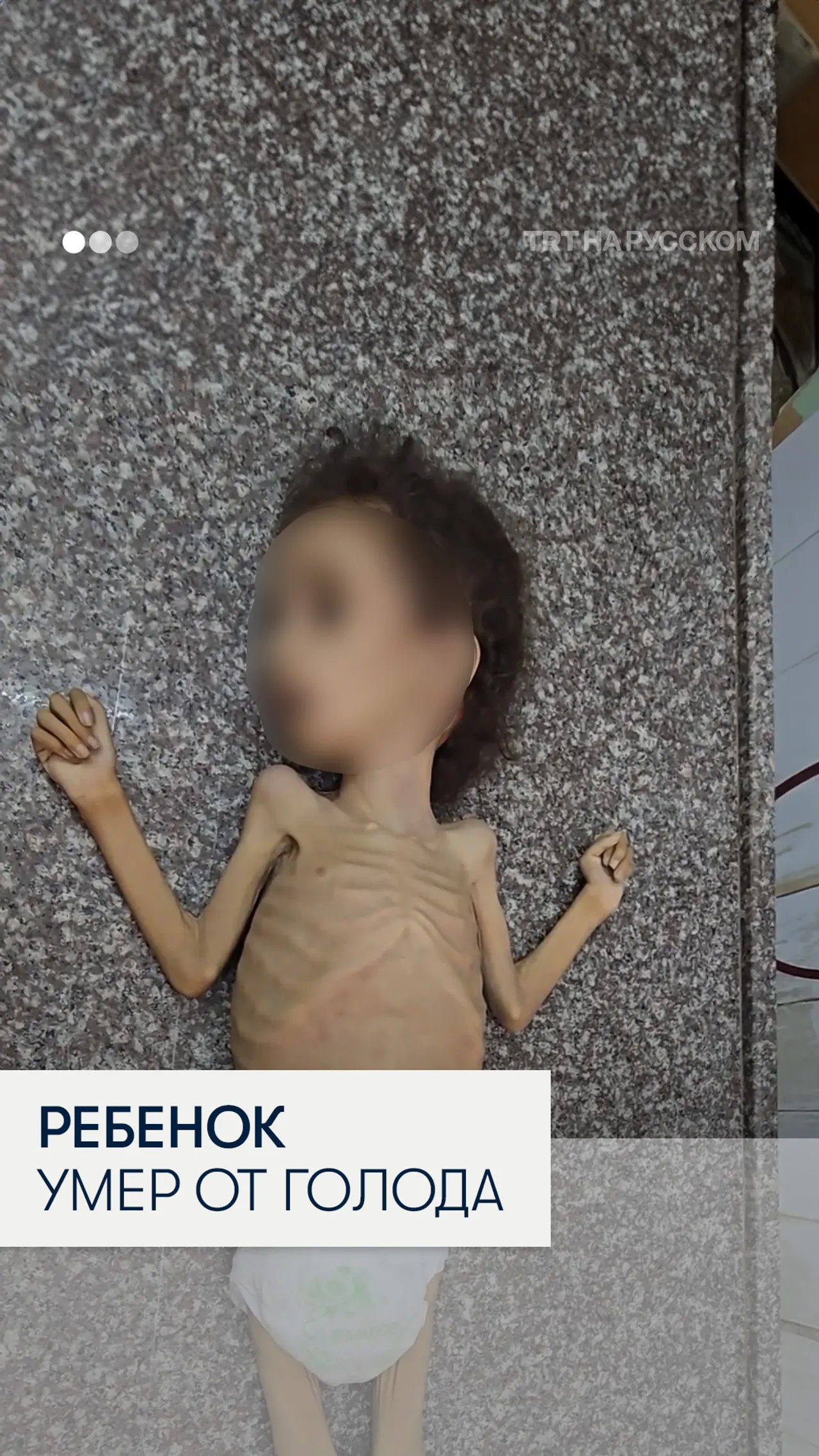 4-летняя палестинка умерла от голода