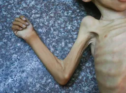 Starving Gaza sends desperate messages: What’s behind the inaction?