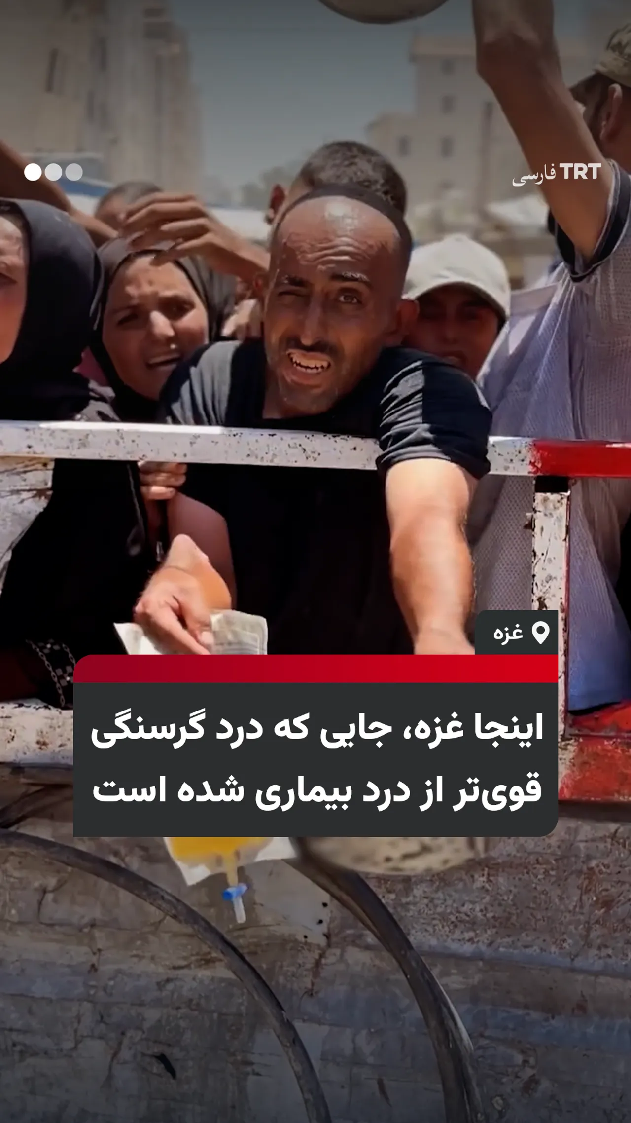 اینجا غزه، جایی که درد گرسنگی قویتر از درد بیماری شده است