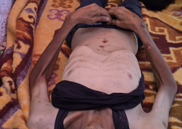 Un tiers des gazaouis affamé depuis plusieurs jours du fait du siège israélien, selon le PAM