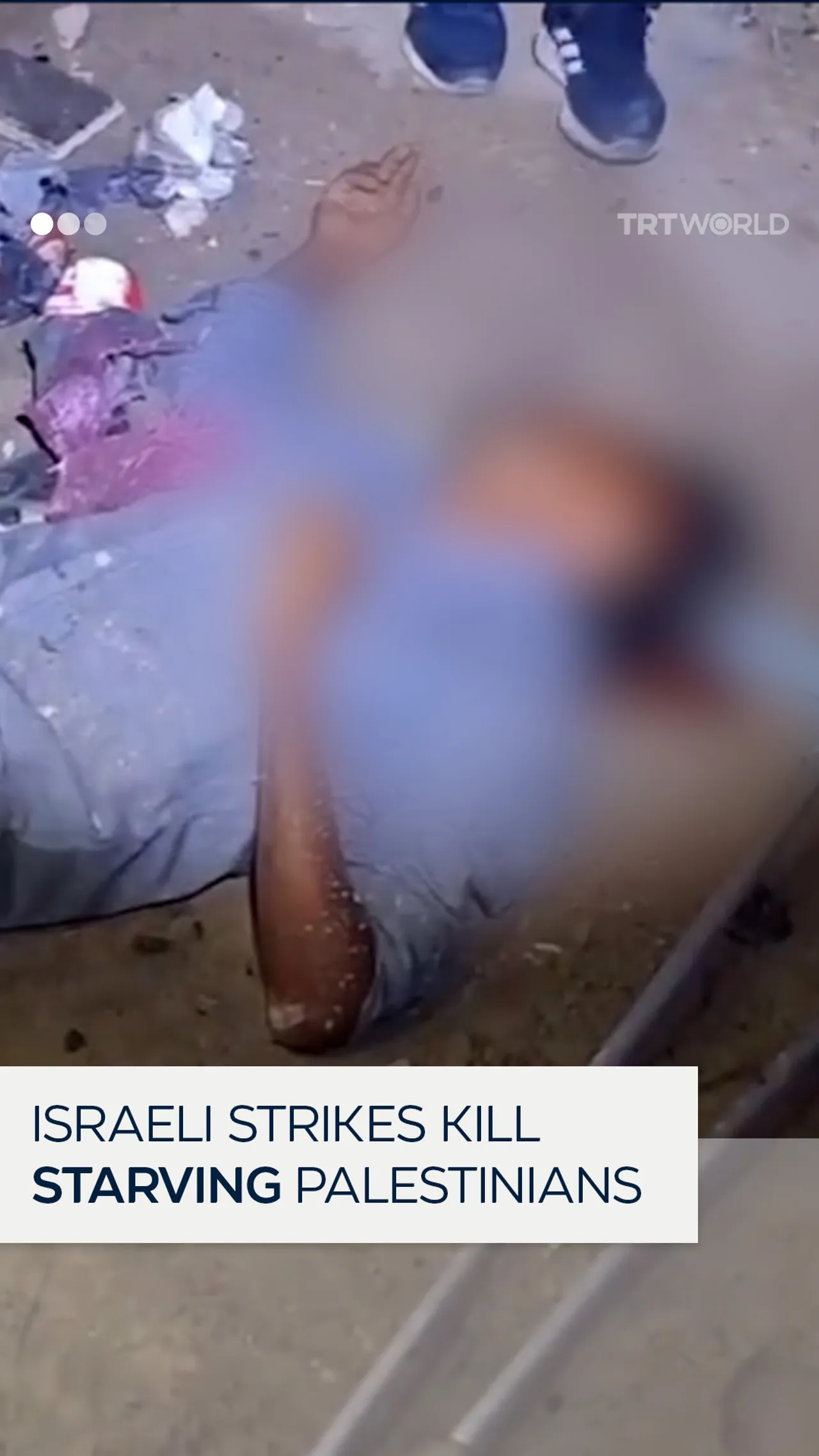 Frail, starving Palestinian amputee killed in Israeli shelling on Gaza